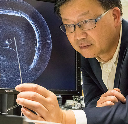 Zhongping Chen has developed a minimally-invasive, dual-modality imaging device that can effectively examine arteries for signs of vascular disease. 