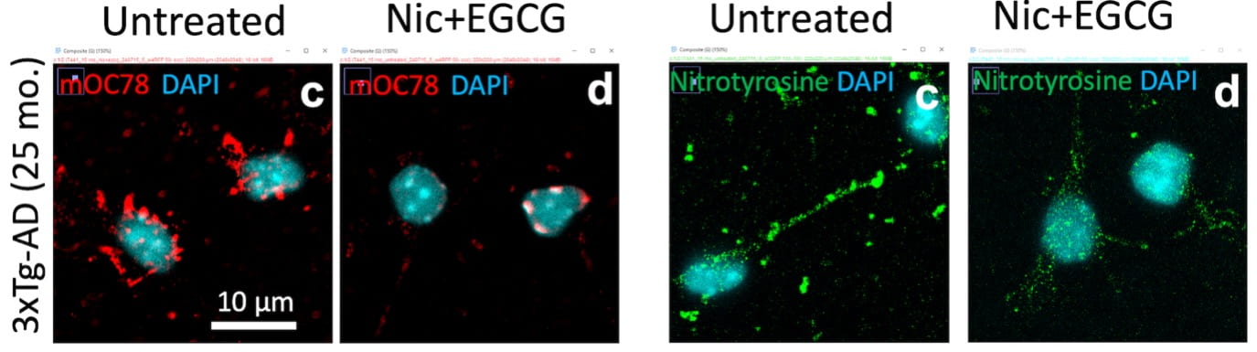 UC Irvine researchers found that a combination of nonpharmaceutical compounds (nicotinamide and epigallocatechin gallate) lessens amyloid beta proteins (red fragments in far-left panel) and nitrotyrosine oxidative damage (green particles in third panel), both indications of the compounds’ brain-clearing properties. Ricardo Santana and Gregory Brewer / UC Irvine