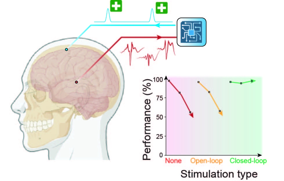 Closed-loop electrical stimulation system to prevent epileptic activity (red) from interfering with physiologic brain functions, like memory (left). This stimulation protocol can prevent the deterioration in memory performance seen in animals with progressive epilepsy (right).